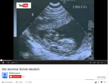 Screenshot Der stumme Schrei, www.youtube.com/watch?v=-hdSblIKGRo 